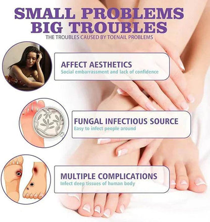 Nail Fungus Spray